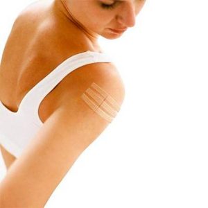 STERI STRIP 3M NEXCARE SUTURA CUTANEA ESTERIL 3